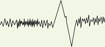 EEG for Stage 2 sleep