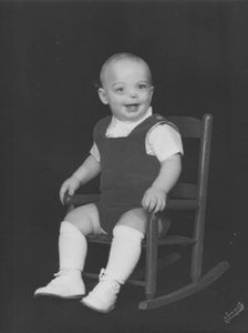 Child with birth defects from thalidomide