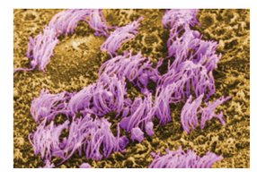 Ependymal cells with cilia