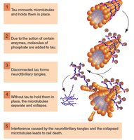 Tau protein and microtubule collapse in Alzheimer's disease