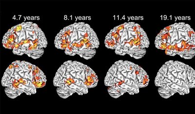 Brain specialization across ages