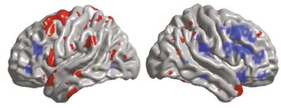 Brain imaging showing areas of activity related to intelligence