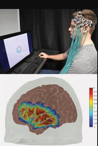 fNIRS probe and cortical sensitivity map