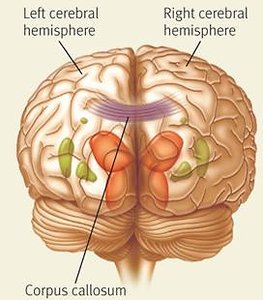 Corpus callosum in sagittal view