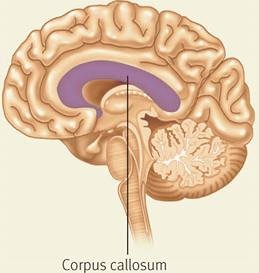 Corpus callosum in coronal view