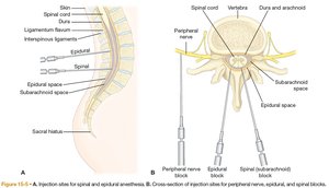Injection sites for spinal and epidural anesthesia