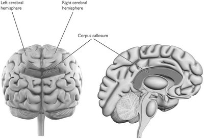 Corpus callosum and brain hemispheres