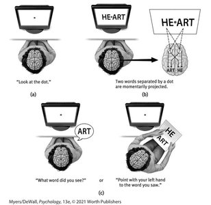 Phineas Gage skull and brain injury