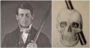 Phineas Gage and his skull injury