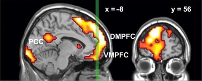 Brain activity during meditation