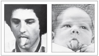Infant imitating tongue protrusion
