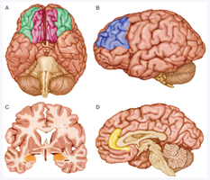 Brain diagrams showing regions implicated in personality disorders