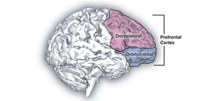 Prefrontal cortex regions involved in OCD