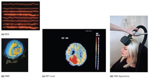 Brain imaging techniques: EEG, fMRI, PET, TMS