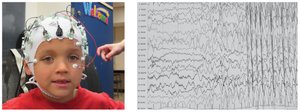 EEG measurement of brain activity
