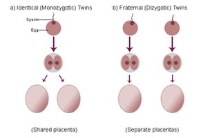 Diagram of identical and fraternal twins formation