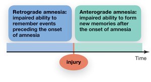 Retrograde and anterograde amnesia diagram
