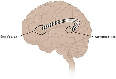 Diagram of the brain showing Broca's area, Wernicke's area, and the arcuate fasciculus