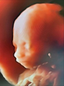 Fetal ultrasound scan at 20 weeks