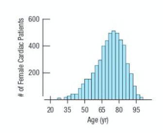 Symmetric distribution histogram