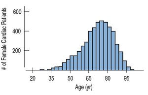 Left-skewed distribution