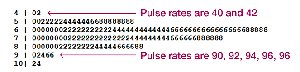 Stemplot of pulse rates